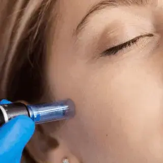 Dermapen Burgos.